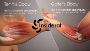 what is the inside of your elbow called